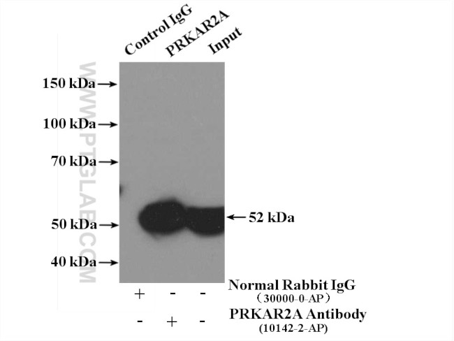 PRKAR2A Antibody in Immunoprecipitation (IP)