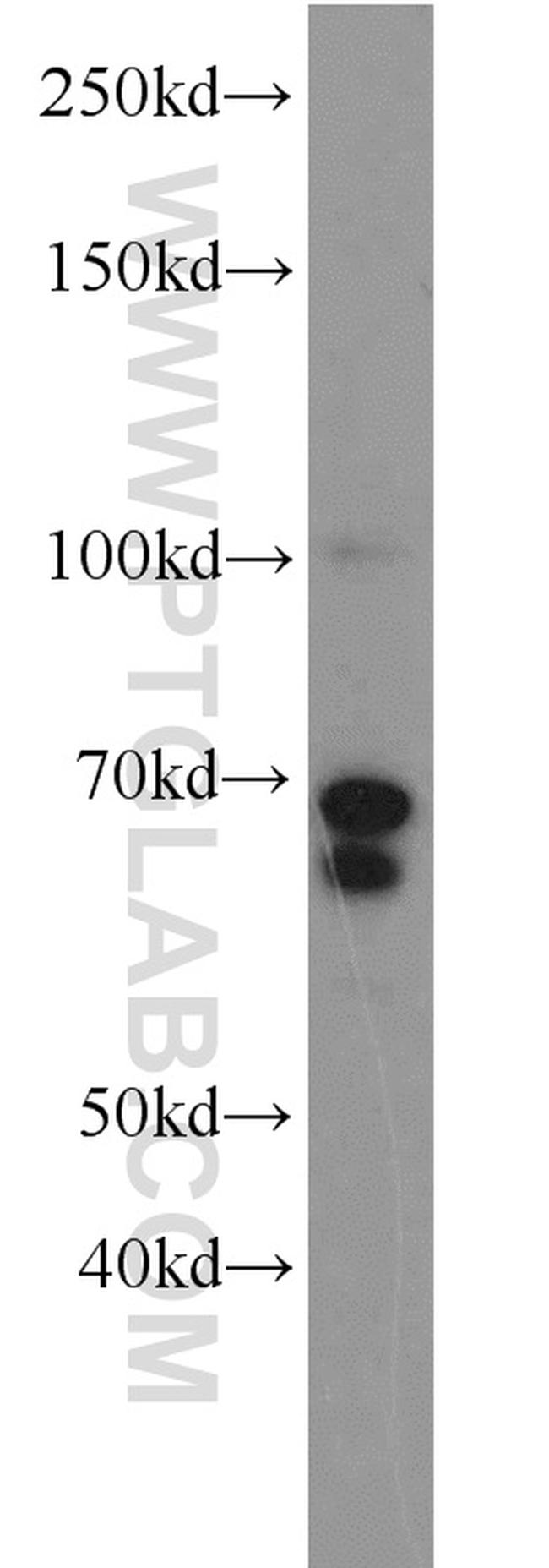 MYCN Antibody in Western Blot (WB)