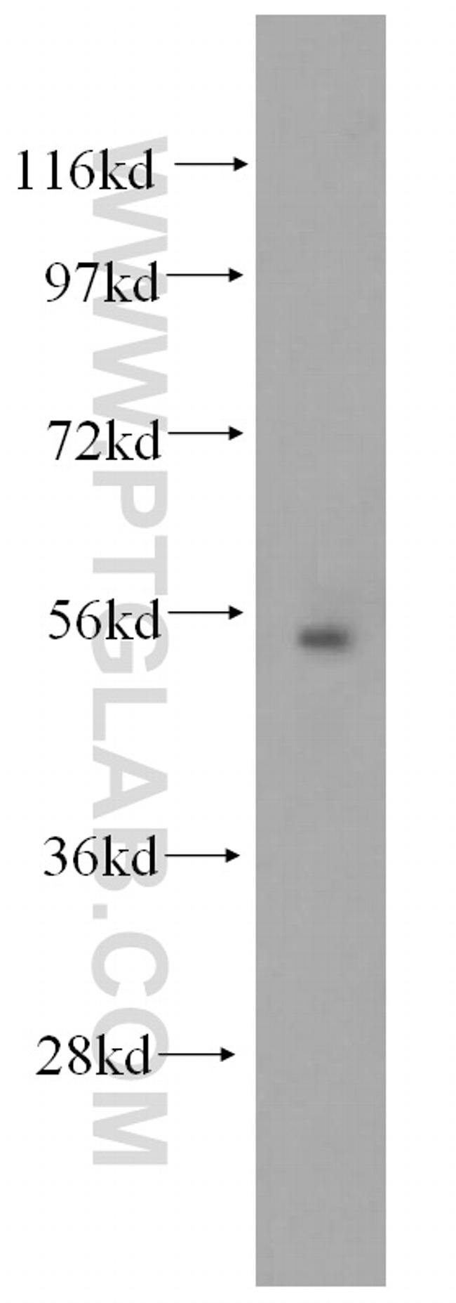 RCN2 Antibody in Western Blot (WB)