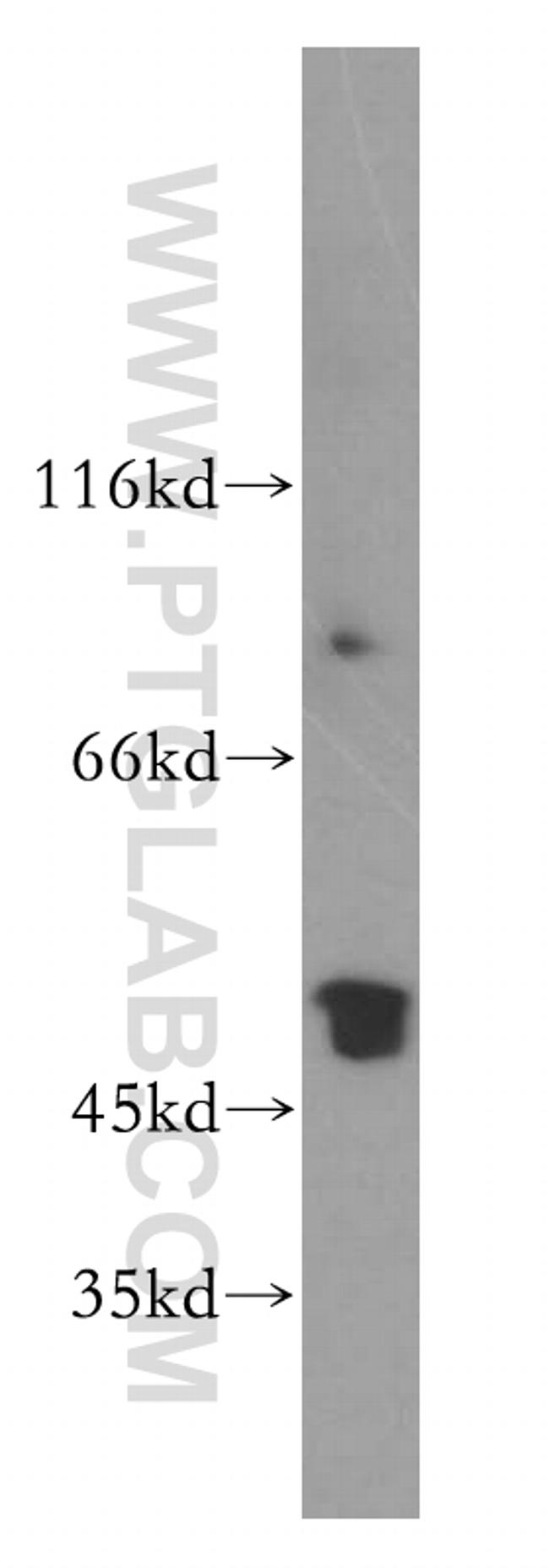RCN2 Antibody in Western Blot (WB)