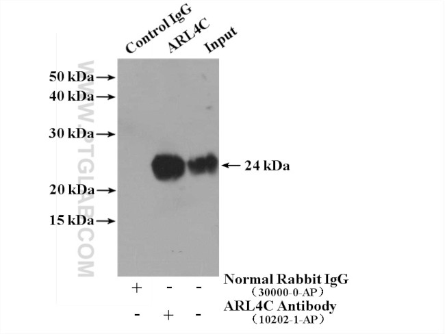ARL4C Antibody in Immunoprecipitation (IP)