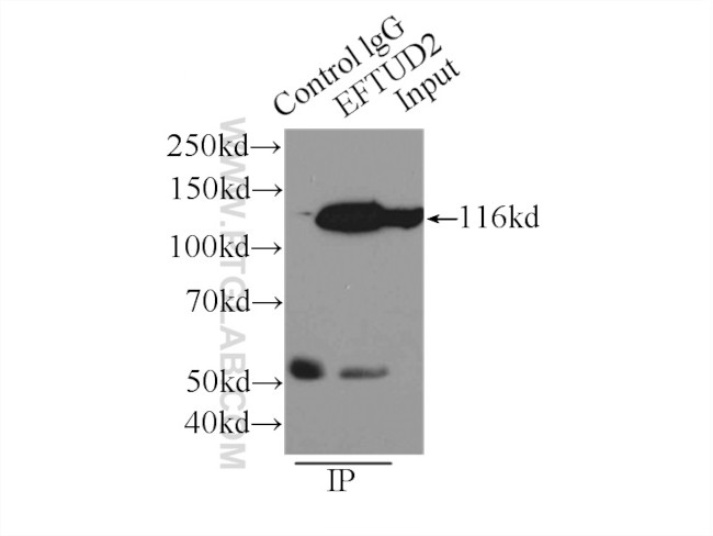 EFTUD2 Antibody in Immunoprecipitation (IP)