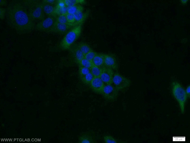 CDC37 Antibody in Immunocytochemistry (ICC/IF)
