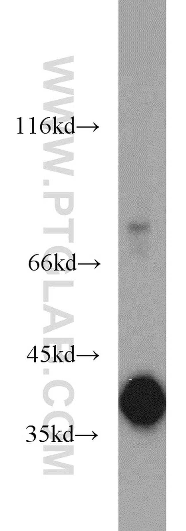 GNB1 Antibody in Western Blot (WB)
