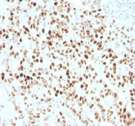 p21WAF1 (Tumor Suppressor Protein) Antibody in Immunohistochemistry (Paraffin) (IHC (P))