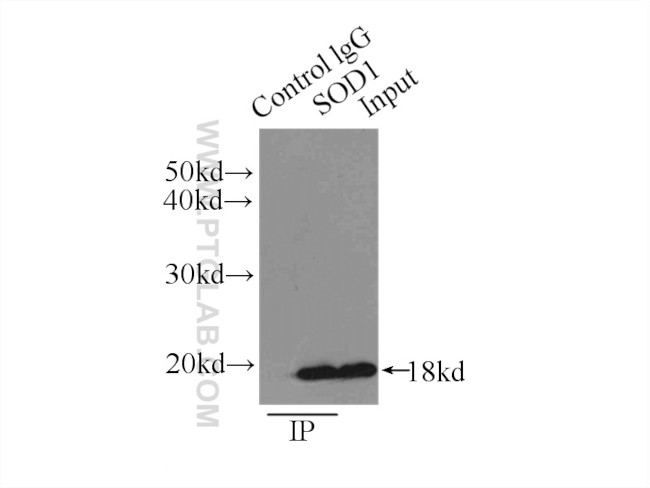 SOD1 Antibody in Immunoprecipitation (IP)