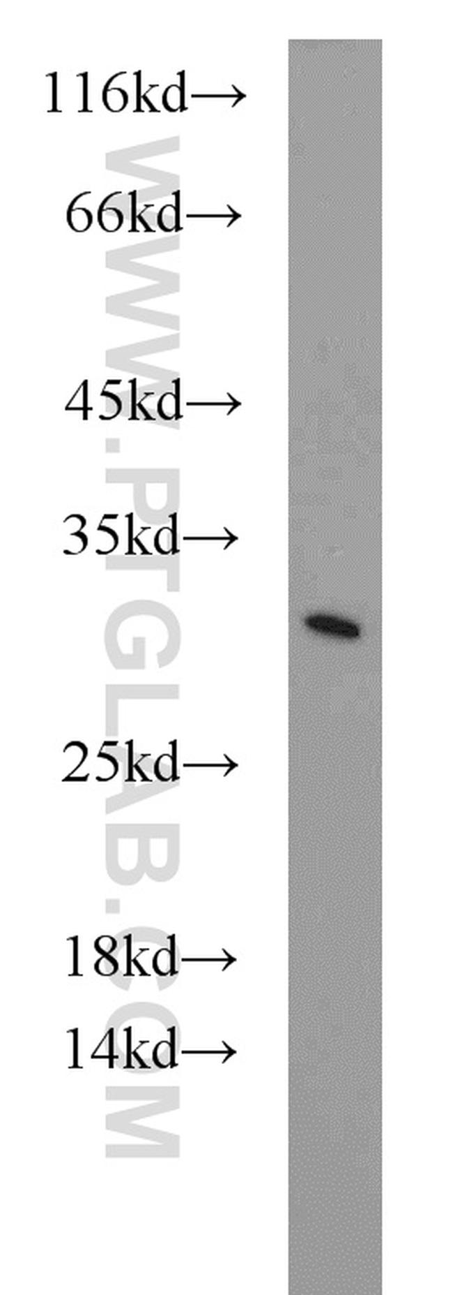 EIF6 Antibody in Western Blot (WB)