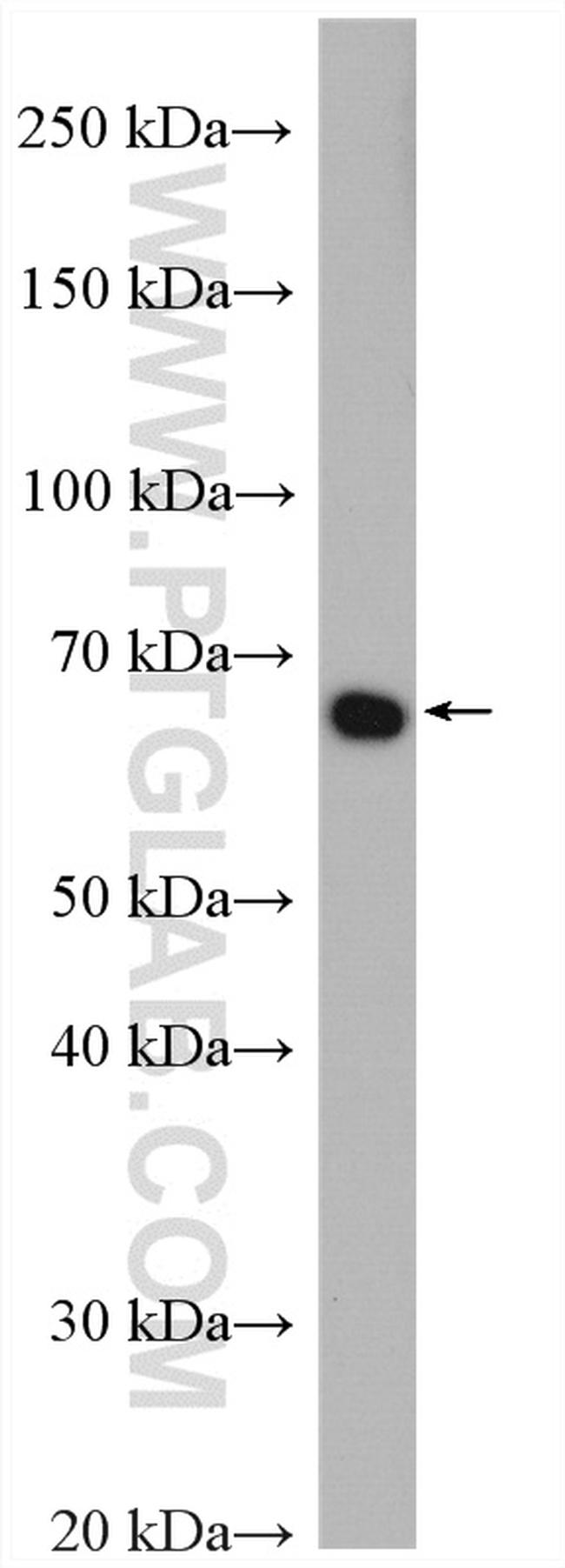 PLK1 Antibody in Western Blot (WB)