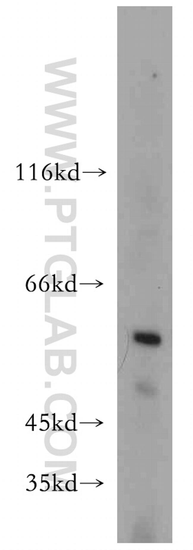 TCP1 Antibody in Western Blot (WB)