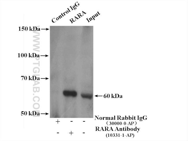 RARA Antibody in Immunoprecipitation (IP)
