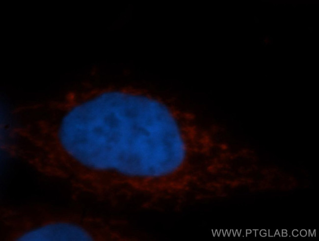 STOML2 Antibody in Immunocytochemistry (ICC/IF)