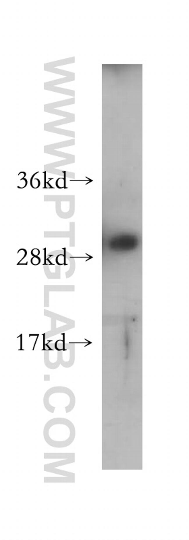 MMP7 Antibody in Western Blot (WB)