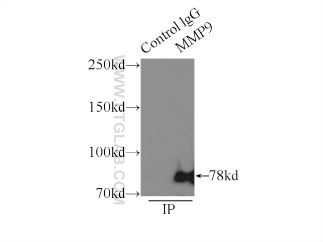 MMP9 (N-terminal) Antibody in Immunoprecipitation (IP)