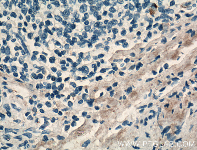 MMP9 (N-terminal) Antibody in Immunohistochemistry (Paraffin) (IHC (P))