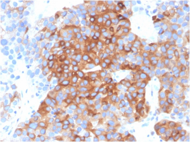 Tubulin beta 3/TUBB3 Antibody in Immunohistochemistry (Paraffin) (IHC (P))