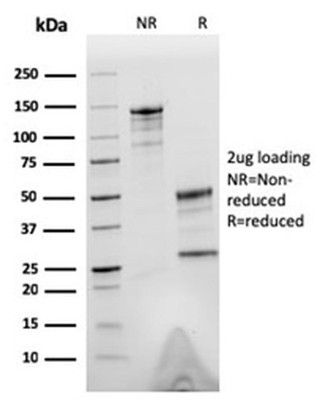 Tubulin beta 3/TUBB3 Antibody in SDS-PAGE (SDS-PAGE)