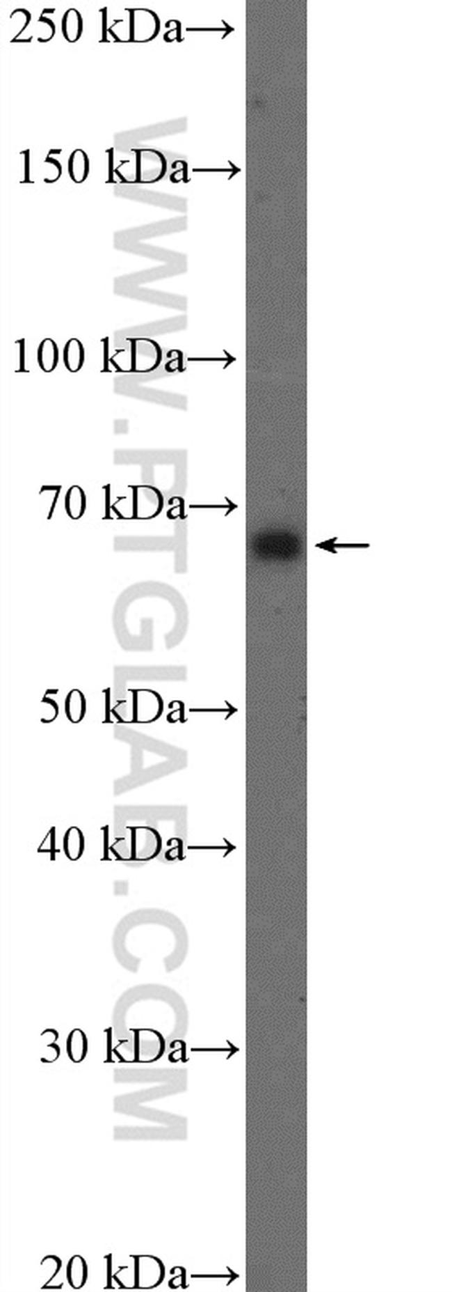 GAD1 Antibody in Western Blot (WB)