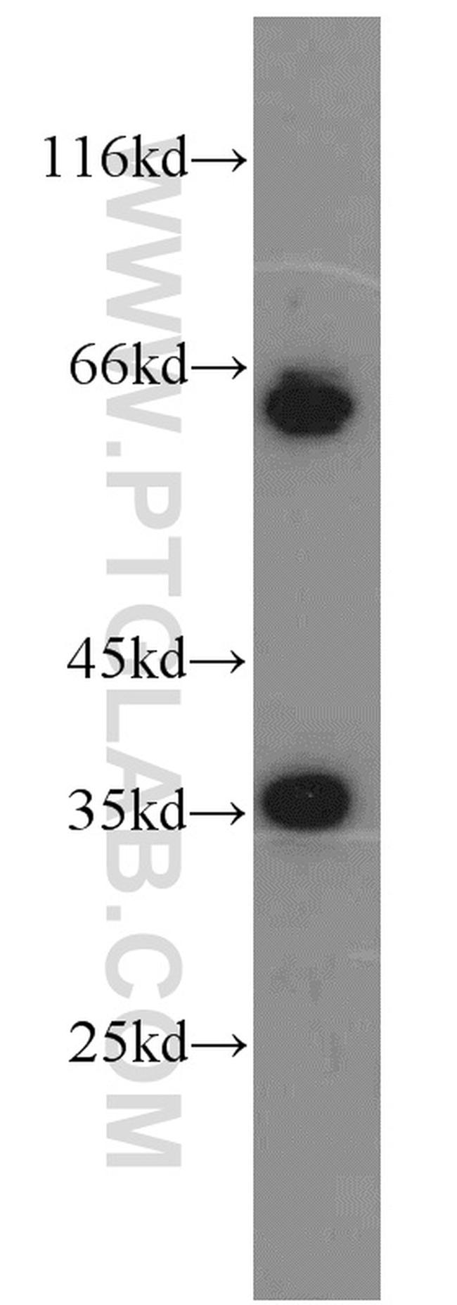 EIF3J Antibody in Western Blot (WB)
