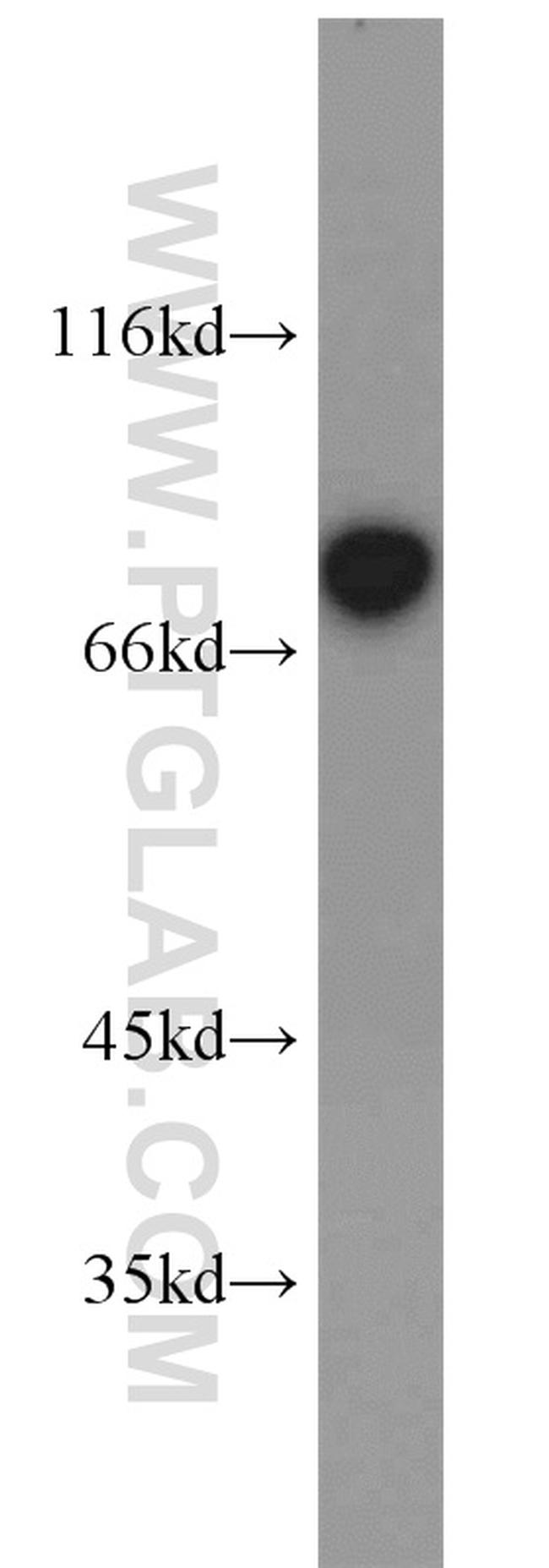 TORC1 Antibody in Western Blot (WB)