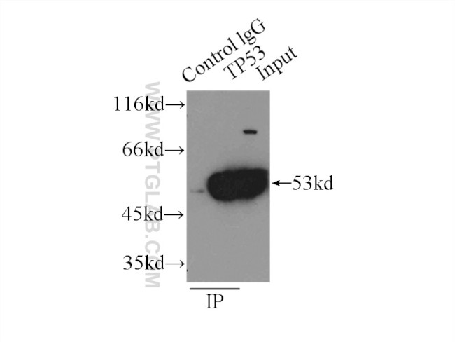 P53 Antibody in Immunoprecipitation (IP)