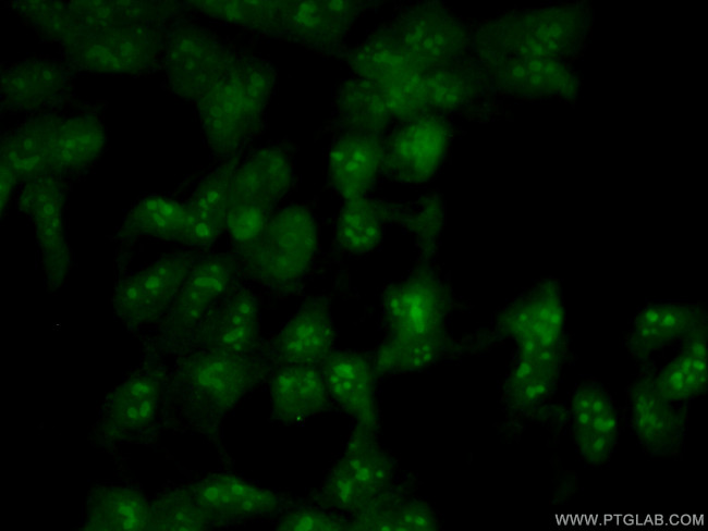 NOP2 Antibody in Immunocytochemistry (ICC/IF)