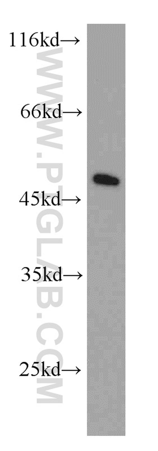 EIF4A3 Antibody in Western Blot (WB)