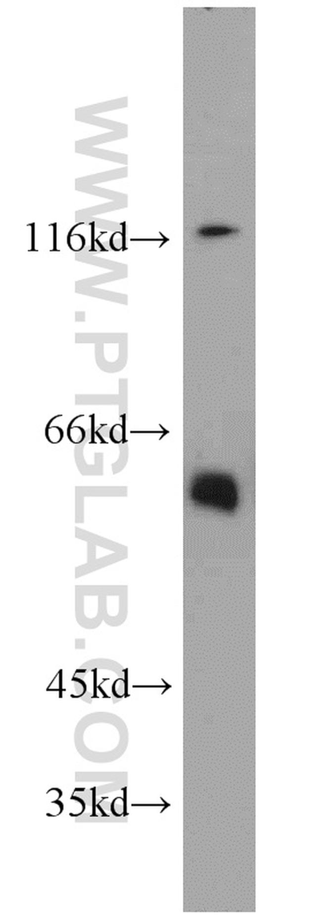Seladin 1 Antibody in Western Blot (WB)