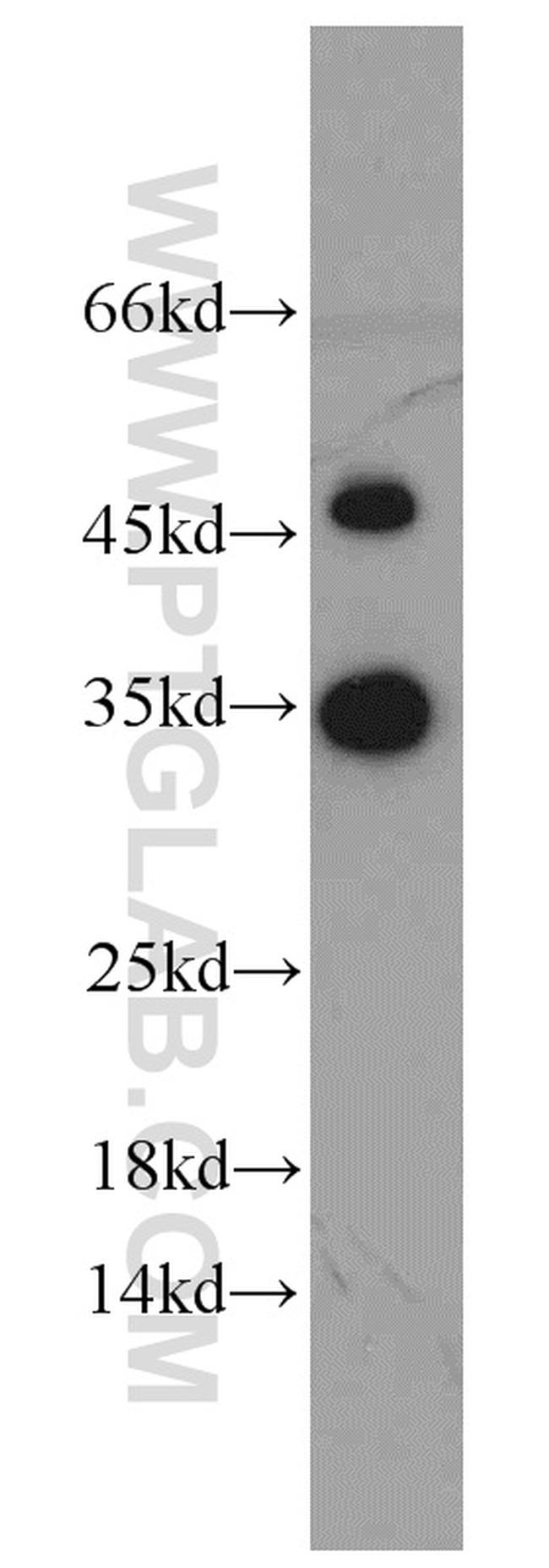 EEF1B2 Antibody in Western Blot (WB)