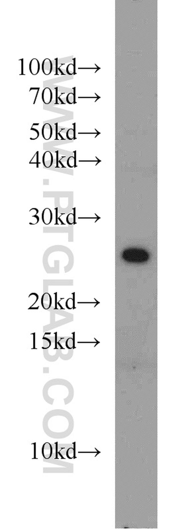 STARD5 Antibody in Western Blot (WB)