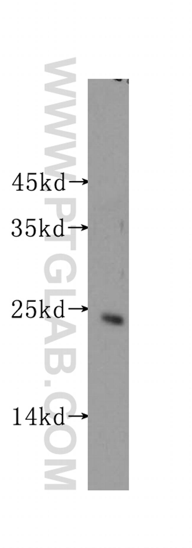 STARD5 Antibody in Western Blot (WB)
