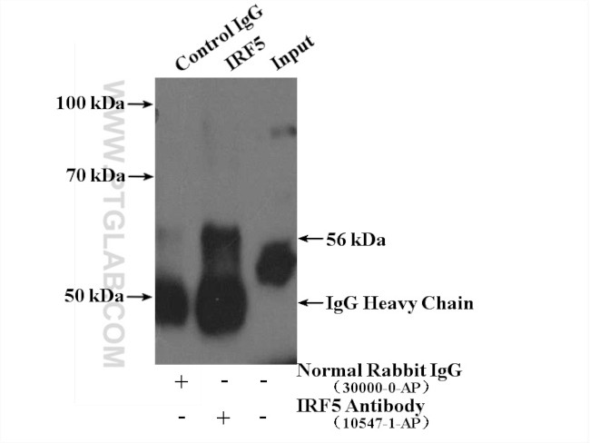 IRF5 Antibody in Immunoprecipitation (IP)