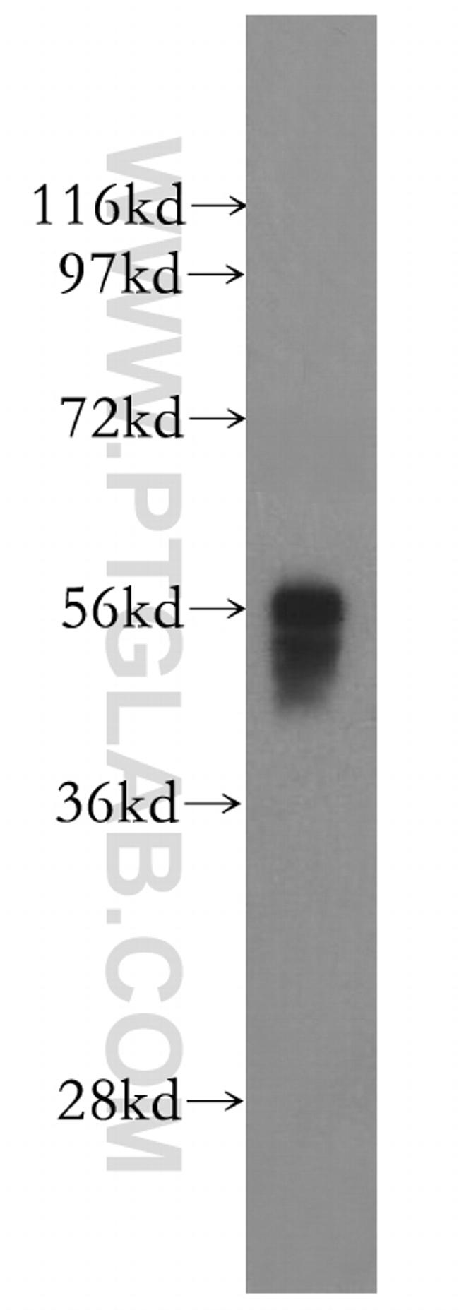 IRF5 Antibody in Western Blot (WB)