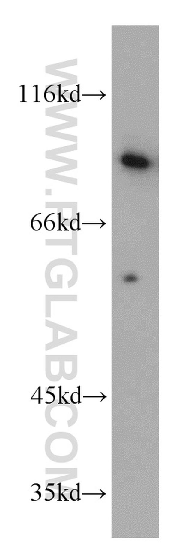 ERCC3 Antibody in Western Blot (WB)
