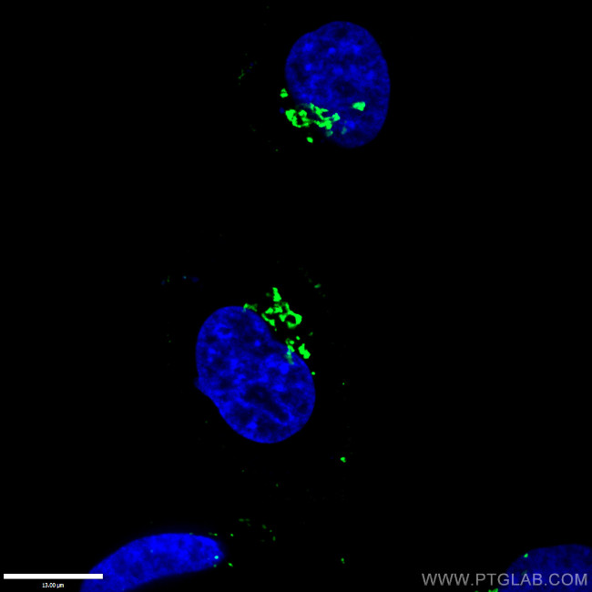 GORASP2 Antibody in Immunocytochemistry (ICC/IF)