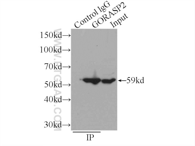 GORASP2 Antibody in Immunoprecipitation (IP)