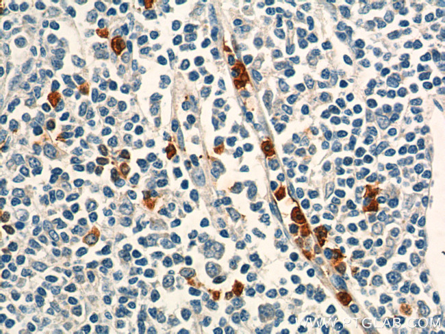 CD24 Antibody in Immunohistochemistry (Paraffin) (IHC (P))