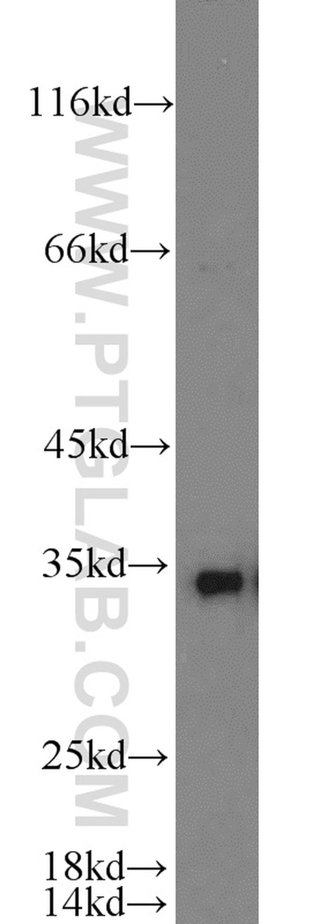 HO-1/HMOX1 Antibody in Western Blot (WB)