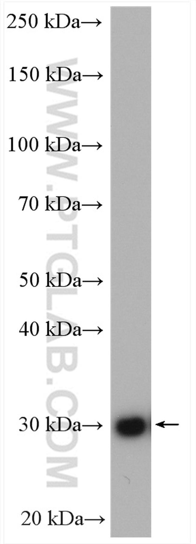 HO-1/HMOX1 Antibody in Western Blot (WB)