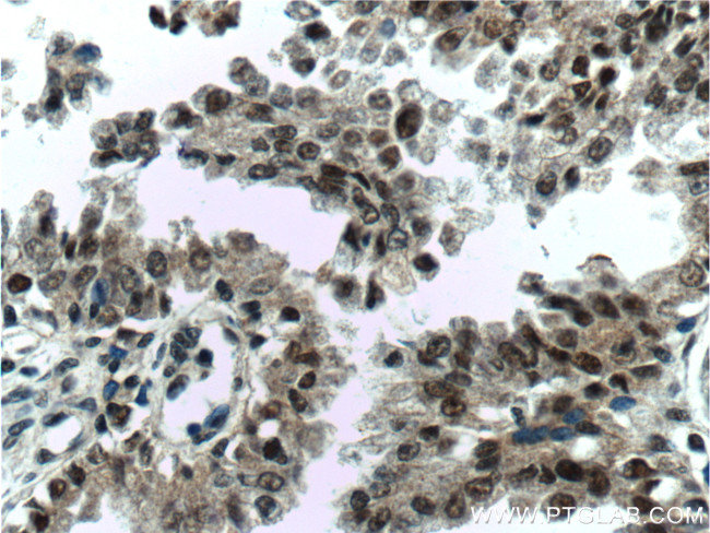 C1D Antibody in Immunohistochemistry (Paraffin) (IHC (P))