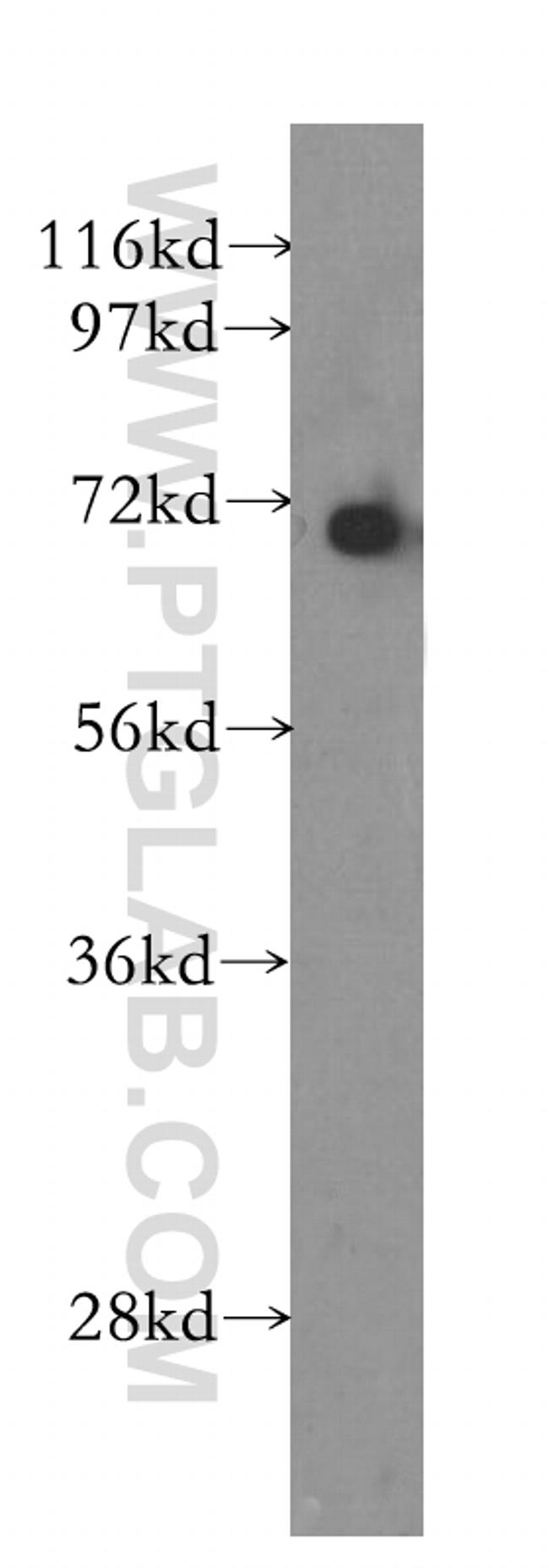 KU70 Antibody in Western Blot (WB)