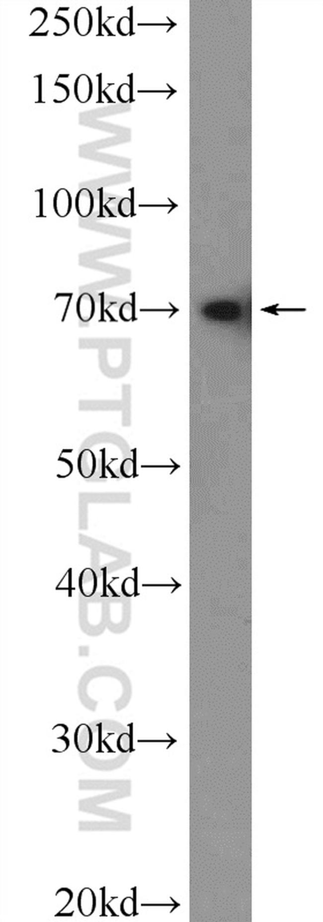 KU70 Antibody in Western Blot (WB)