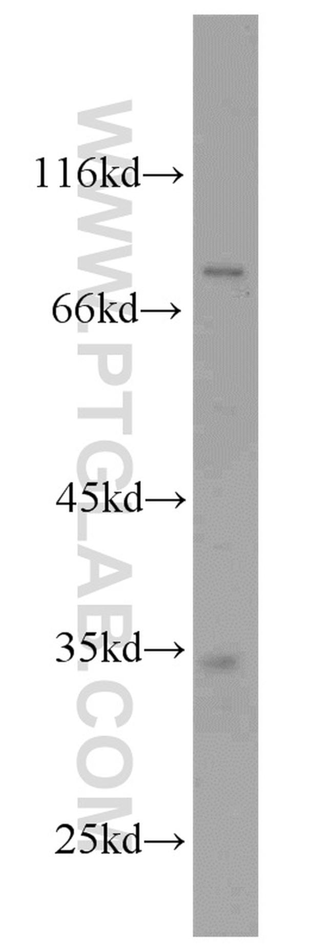 DARPP32 Antibody in Western Blot (WB)