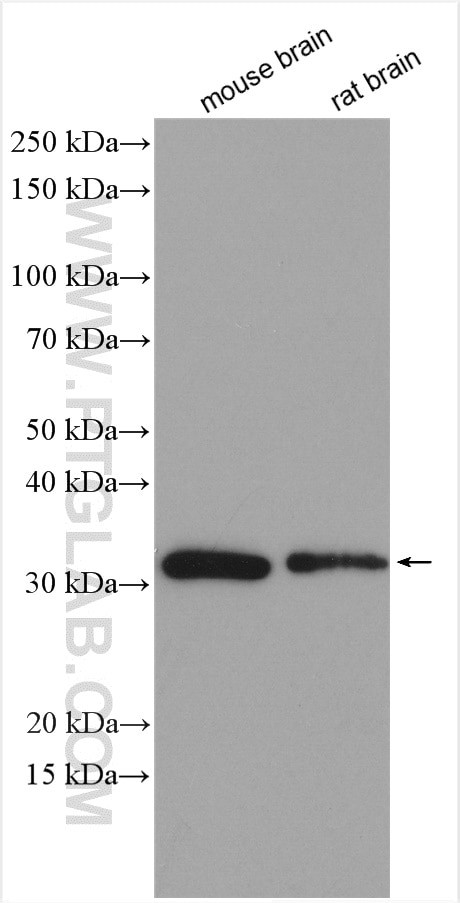 NIPSNAP3A Antibody in Western Blot (WB)