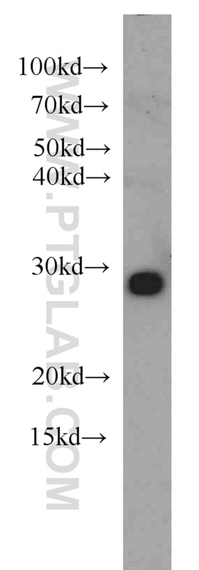 NIPSNAP3A Antibody in Western Blot (WB)