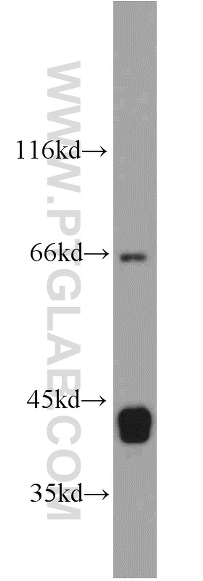SEPT9 Antibody in Western Blot (WB)