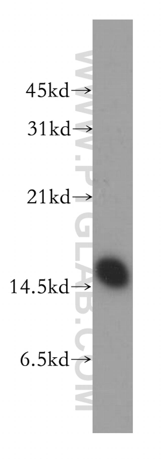 COTL1 Antibody in Western Blot (WB)