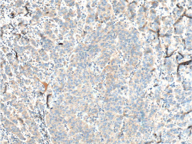 TRIM9 Antibody in Immunohistochemistry (Paraffin) (IHC (P))