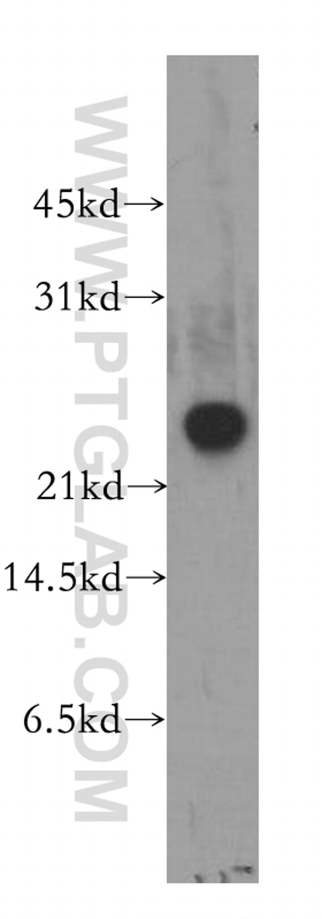 RAB3C Antibody in Western Blot (WB)