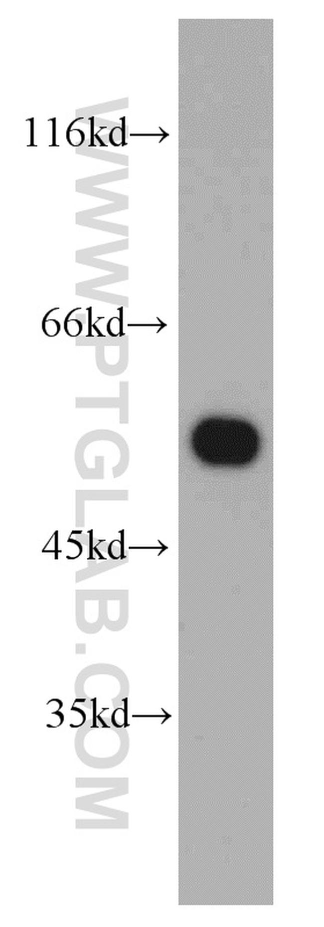 Sestrin 2 Antibody in Western Blot (WB)