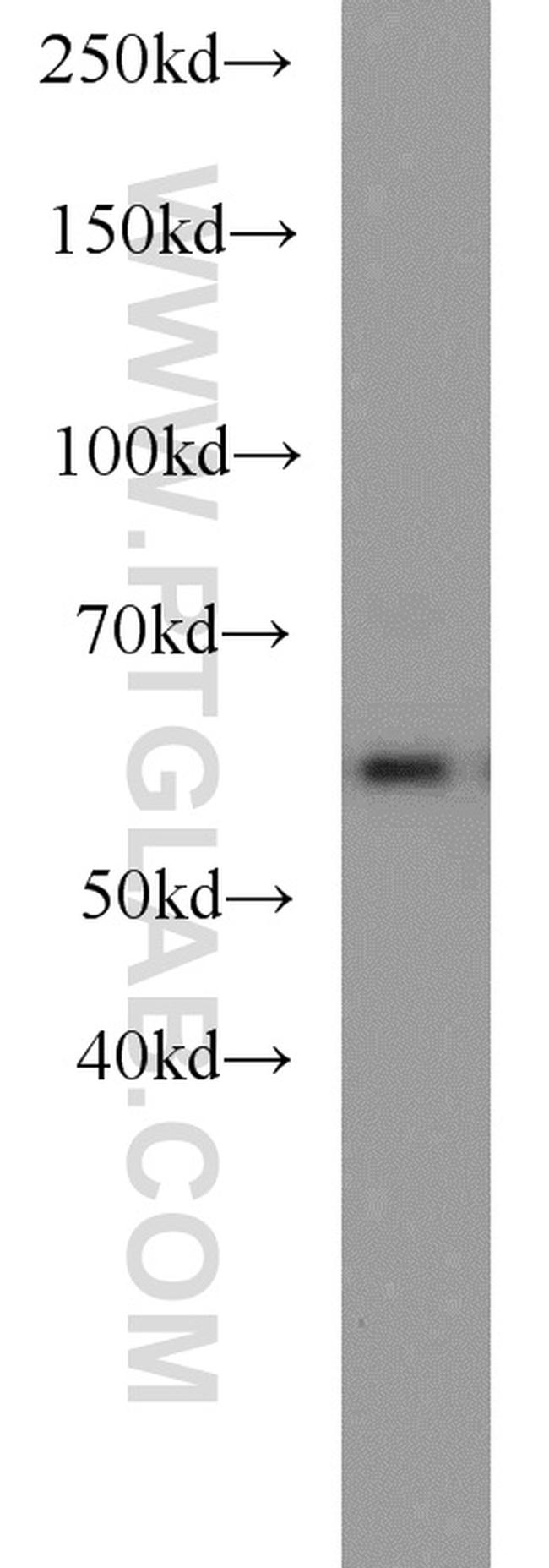 Sestrin 2 Antibody in Western Blot (WB)